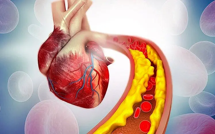 بدترین خوراکی‌ها برای افزایش کلسترول خون کدامند؟